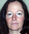 Cornelia Lange